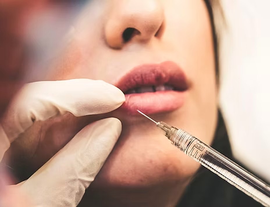 Lip filler treatment in a private suite